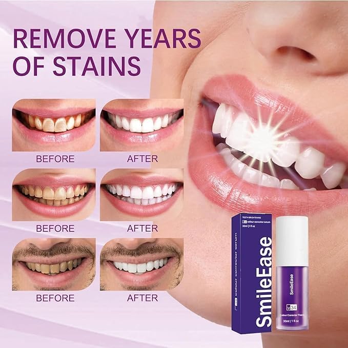 Purple Toothpaste for Teeth Whitening, Purple Whitening Toothpaste for Adults,Tooth Stain Remover Gel - Tooth Whitener Suitable for Smoking, Coffee, and Removing Dental Stone   