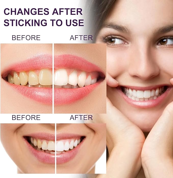 Purple Toothpaste for Teeth Whitening, Purple Whitening Toothpaste for Adults,Tooth Stain Remover Gel - Tooth Whitener Suitable for Smoking, Coffee, and Removing Dental Stone   